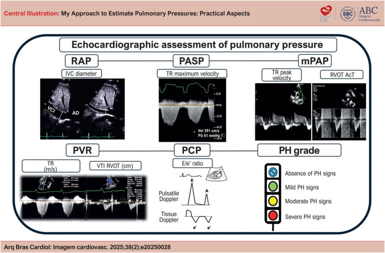 My Approach to Estimate Pulmonary Pressures: Practical Aspects - ABC ...