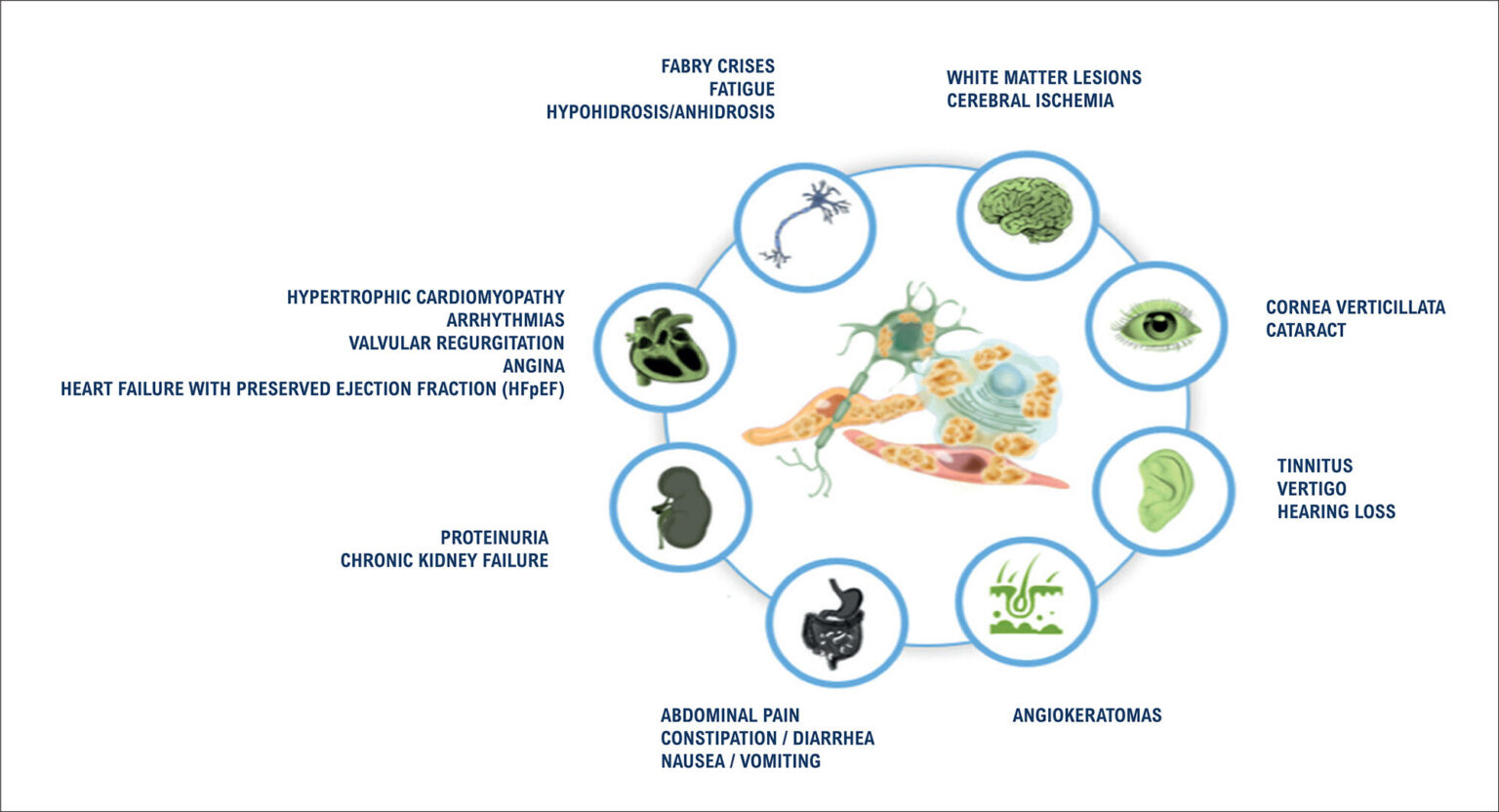 My Approach to Diagnose Fabry Disease - ABC Imaging