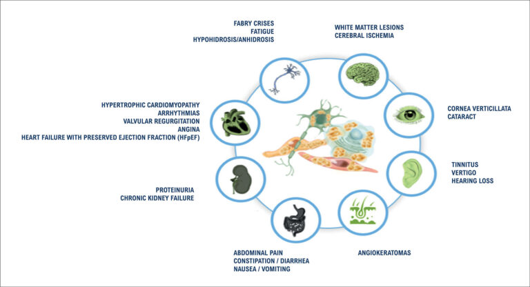 My Approach to Diagnose Fabry Disease - ABC Imaging