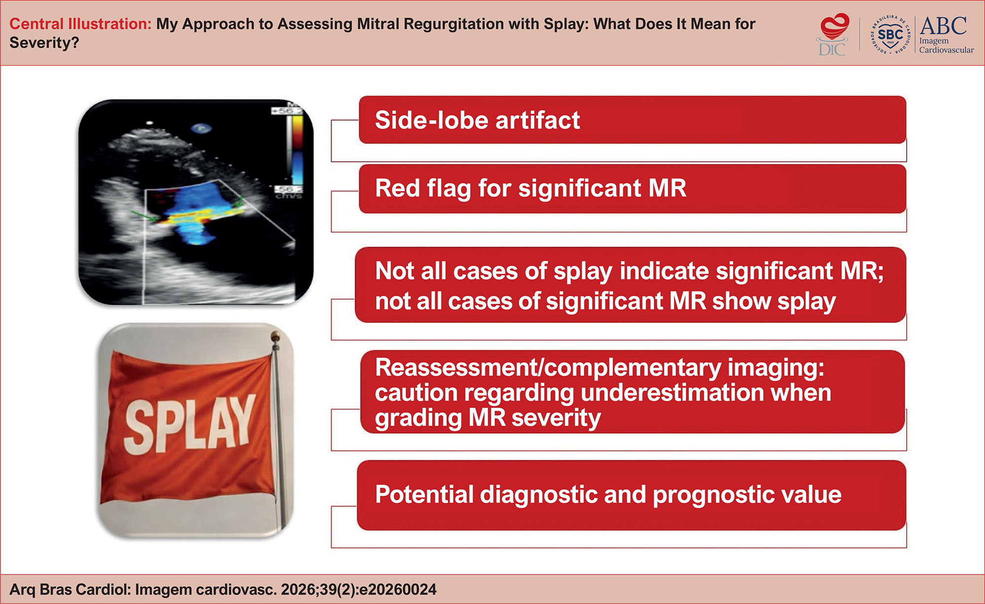My Approach to Assessing Mitral Regurgitation with Splay: What Does It ...